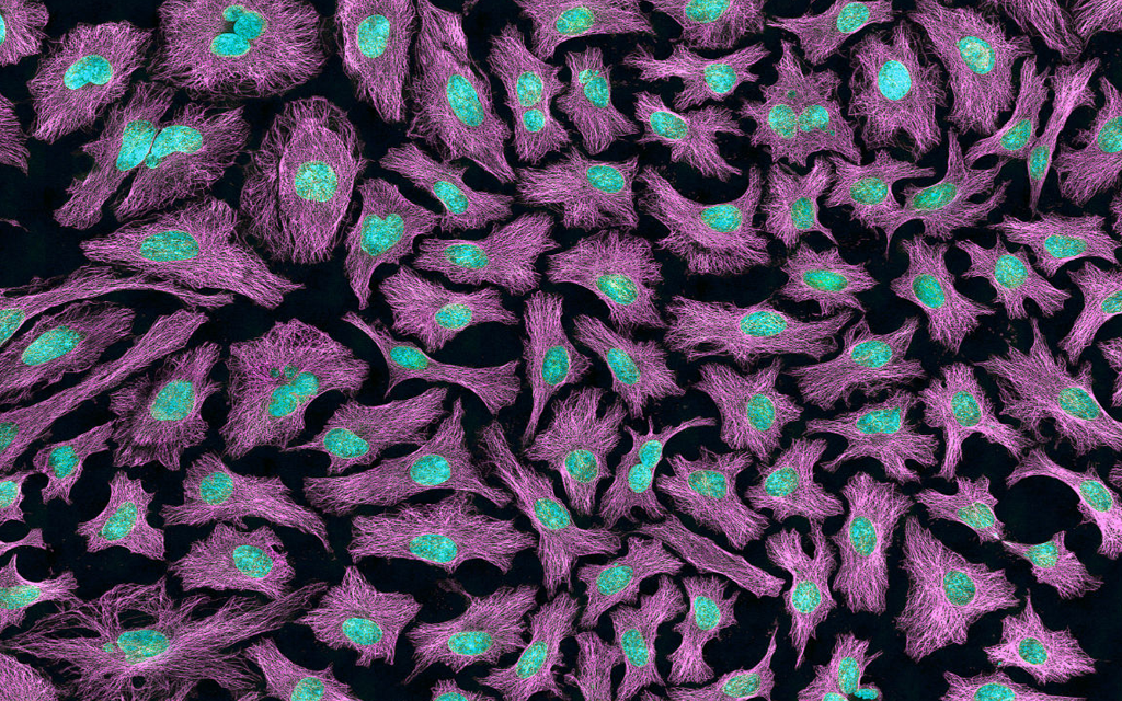 110b1c4b46cfeb7cd35235318bbff582